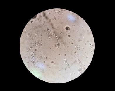 今天成功中招，年底就准备迎接我的兔宝宝拉~